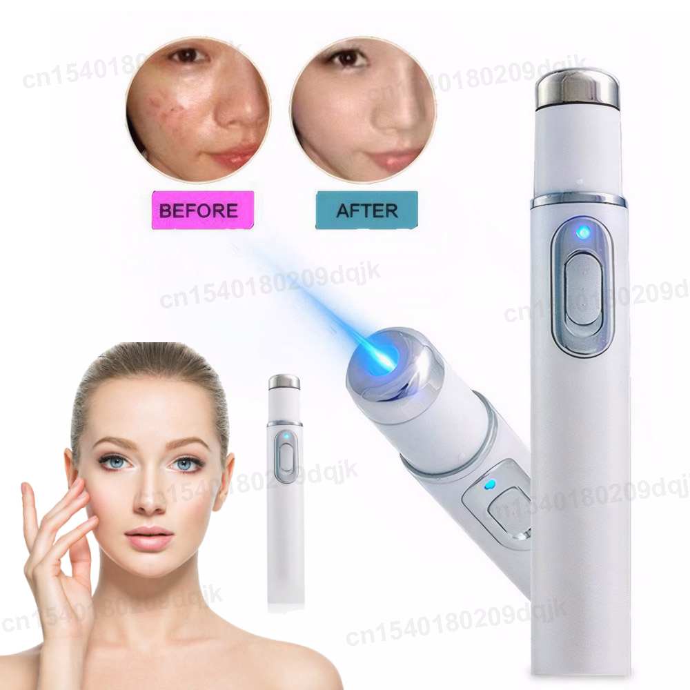 Acne Light Therapy Pen - قلم حب الشباب للعلاج بالضوء الأزرق،