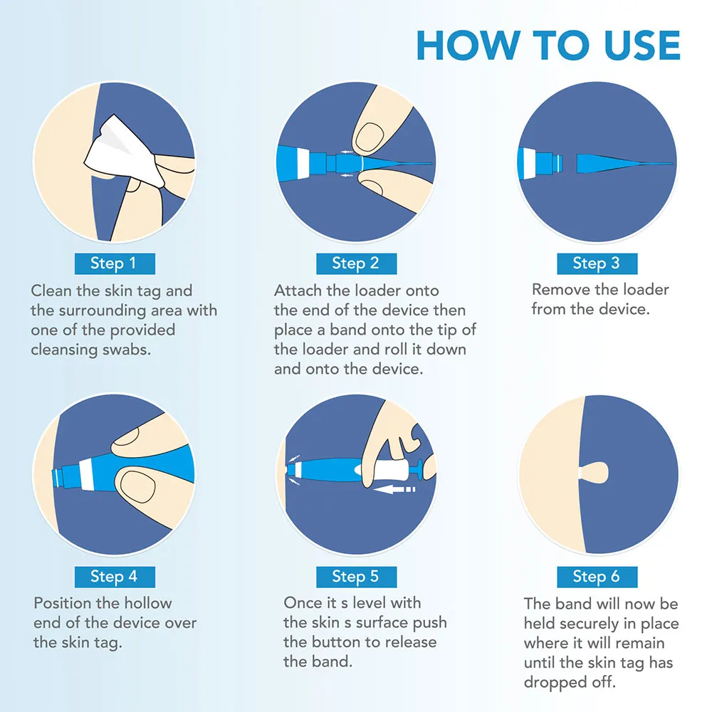 مجموعة أدوات إزالة علامات الجل - مراجعة Acne Light Therapy Pen وسعره